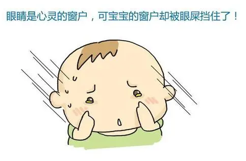 新生儿眼屎多，一定警惕眼部炎症